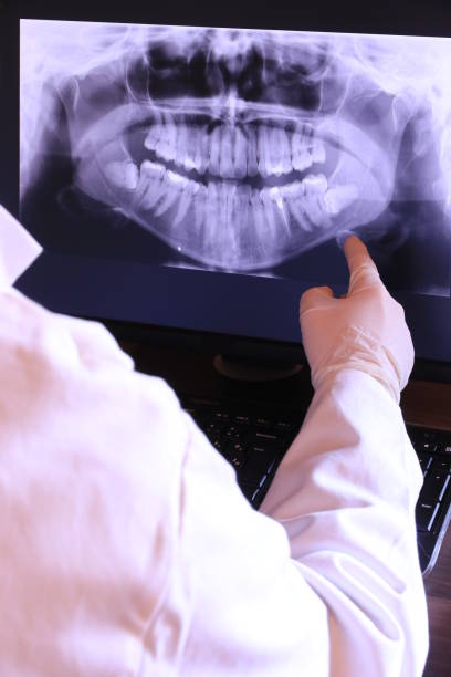 Best Emergency Wisdom Tooth Extraction in Kenneth City, FL